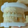 Buy cheap Layered Zirconia Bridge For Fixed Restoration Beautiful Smiles Professional Stable from wholesalers