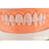 Buy cheap Custom Made IPS Porcelain Emax Veneers Dental Restorations Chipping Resistant from wholesalers