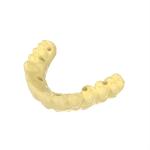 DLP Printer Temporary Crown Resin Durable 3d Printer Resin Dental