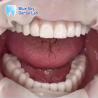 Buy cheap Nature Design Dental Implant Case Implant Operation Cases For Multiple Choices from wholesalers