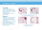 hifu machine/ high intensity focused ultrasound from Beijing LEADBEAUTY