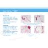 Buy cheap HIFUSLIM high intensity focused ultrasound vertical hifu beauty machine from wholesalers