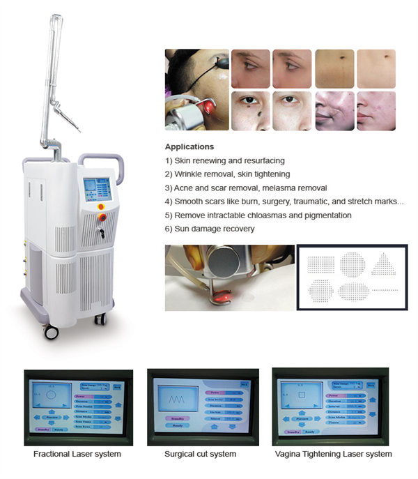 Freckle Removing Co2 Fractional Laser Equipment 40W Chloasma Treatment