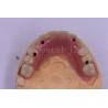Buy cheap Dental Implant Titanium Tooth Crown Precision Fit Custom Design from wholesalers