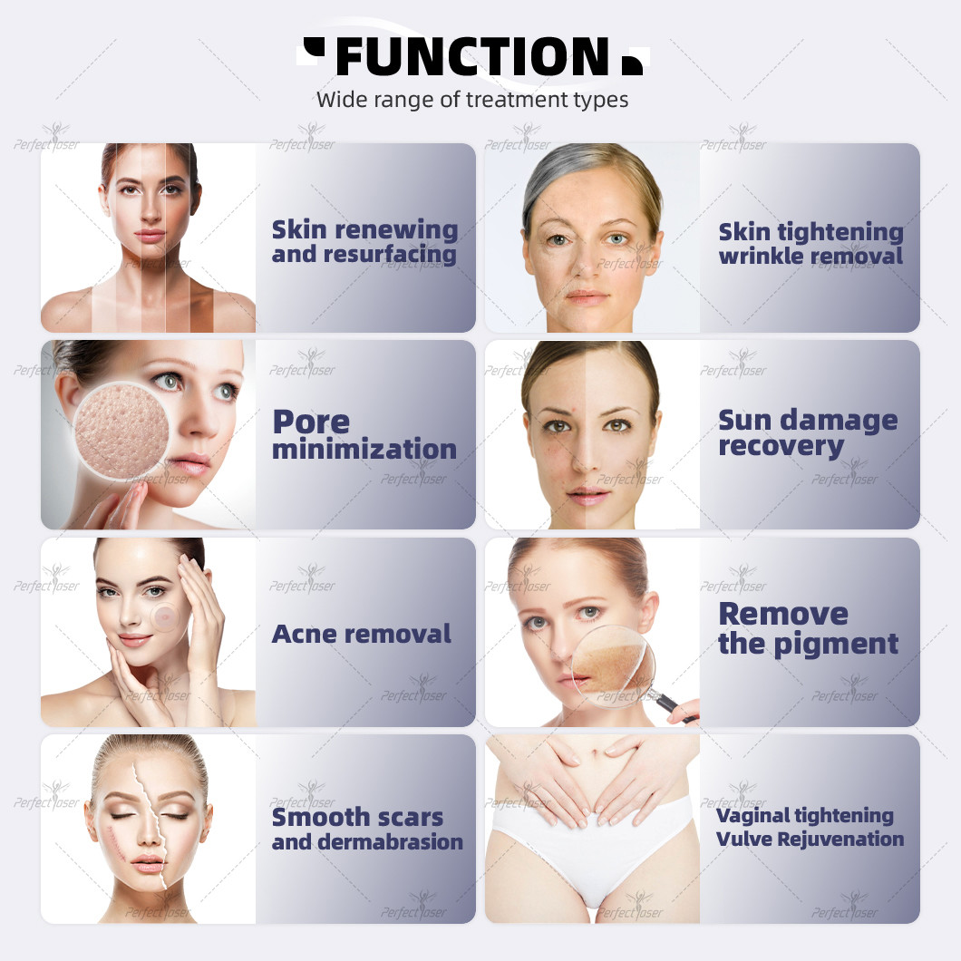 RF Tube 60W Big Power Fractional Co2 Laser Stretch-Mark Removal Skin Resurfacing Bring Youth Back