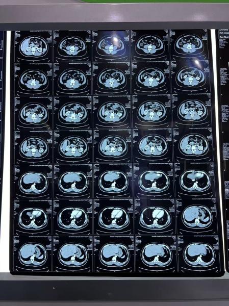 Buy cheap Medical Equipment Blue Density Laser X Ray Thermal Print Film from wholesalers