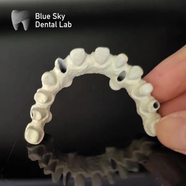 Buy cheap Titanium Frame Malo Bridge Dental Custom Malo Implant Bridge from wholesalers