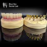 Buy cheap Screw retained MUA abutment Implant Cases Zirconia crowns Multilayer pink from wholesalers