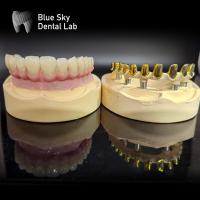 Buy cheap Screw retained MUA abutment Implant Cases Zirconia crowns Multilayer pink product