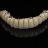 Buy cheap All On 6 PFM Titanium Bridge Dental Crown Full Arch Implant from wholesalers