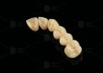 Strong Aesthetic Porcelain Fused To Zirconia For Natural Looking Restorations