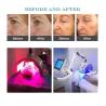 Buy cheap Red Blue Yellow 583nm PDT Bio LED Phototherapy Machine For Pore Bulky Remove from wholesalers