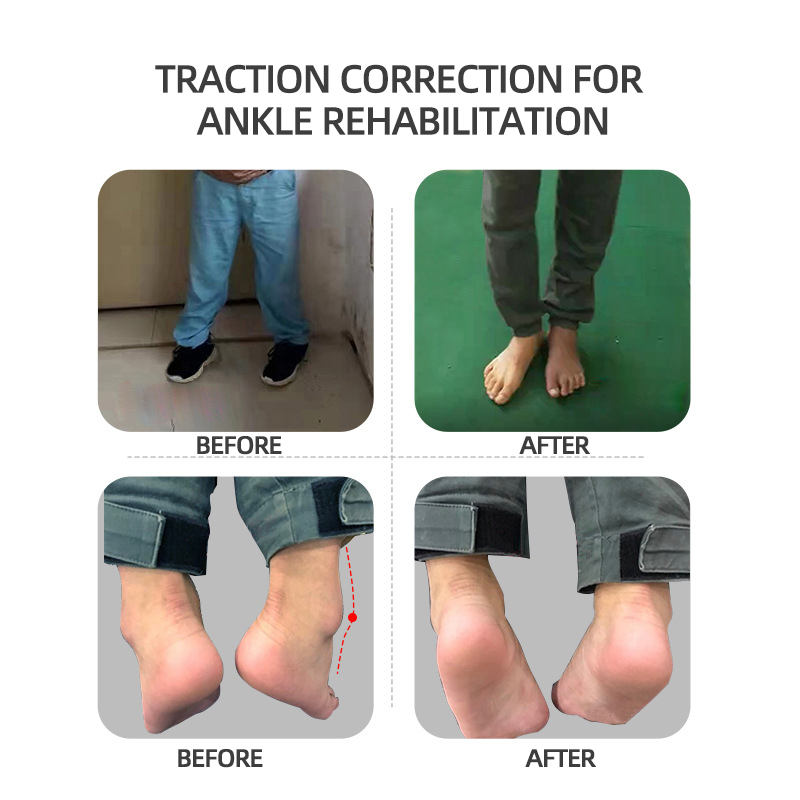 Customized Hemiplegia Physiotherapy Rehabilitation Equipment For Stroke Patients