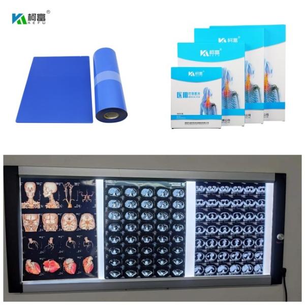 Buy cheap Medical Inkjet Blue Base X Ray Film Digital Image With 210um For 14x17inch from wholesalers