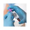 Buy cheap UV Printing OPP Medication Warning Labels For Blood Collection Tube from wholesalers