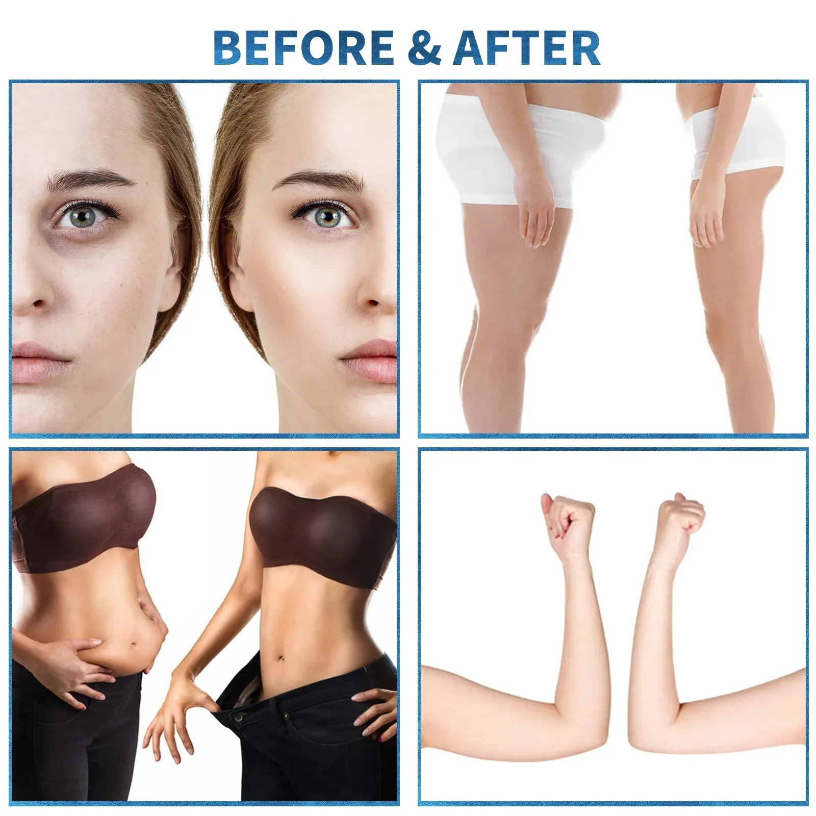 Skin Tightening Inner Ball Roller Machine