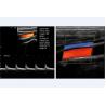 Buy cheap Mobile Medical Ultrasound Machine 3D Color Doppler Ultrasound from wholesalers