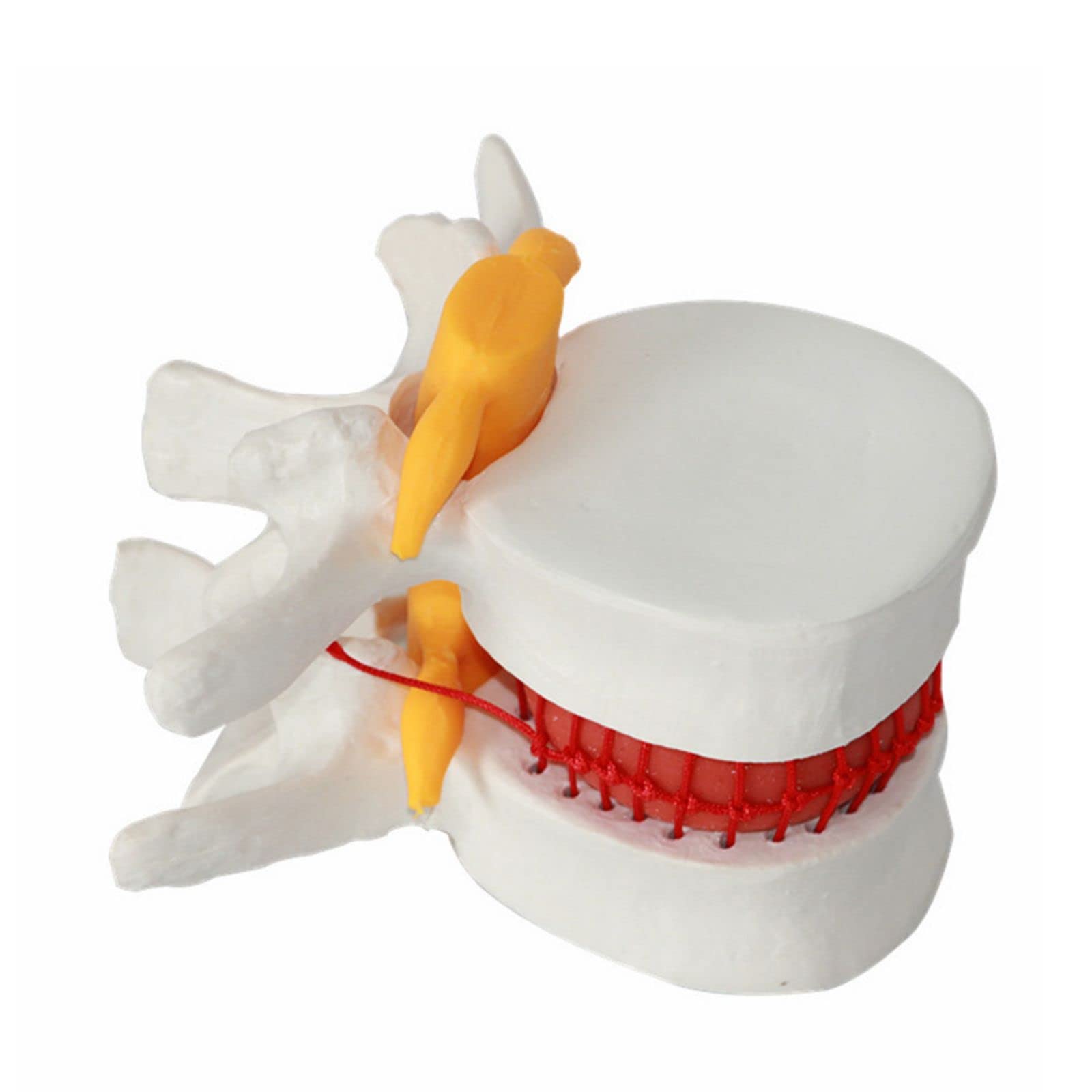 3D Vertebrae Cervical Spine Model 1.5X Lumbar Vertebral Spine Herniation