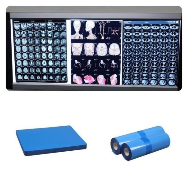 Buy cheap DR CT MRI Medical Inkjet X Ray Films 210 Microns Blue Base Ink 8x10 A4 A3 10inch Roll from wholesalers