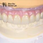Universal Multiple Choices Implant Cases Designed For Smooth Surface And Sterile