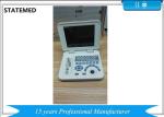 Pregnancy Portable Ultrasound Equipment / Laptop Ultrasound Scanner USB Port