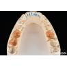 Buy cheap Customizable Shape Composite Inlays And Onlays Dental Stain Resistance Long Lasting from wholesalers