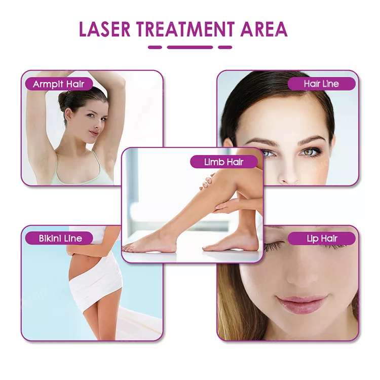 DPL most intelligent and professional portable permanent Hair Removal 808nm laser diode beauty equipment