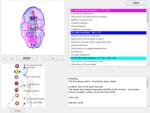 85% Accuracy 8D Nls Body Health Analyzer Advanced Quantum Magnetic Aura Chakra