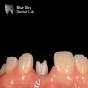 Buy cheap Hypoallergenic Dental Implant Zirconia Abutment Biocompatible from wholesalers