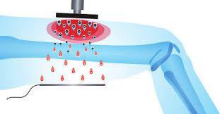 450khz 300W Medical Tecar Physical Therapy For Rehabilitation