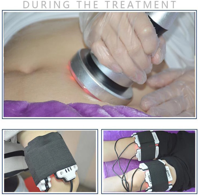 360 Cryolipolysis Slimming Machine Fat Freezing Lymphatic Drainage Device
