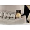 Buy cheap Biocompatible Dental Implant Crown And Bridge Aesthetically Pleasing For Safe Oral from wholesalers