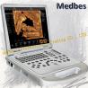 Buy cheap Portable Ultrasound Machine Doppler Ultrasonic Diagnostic E2 Sonoscape Price from wholesalers