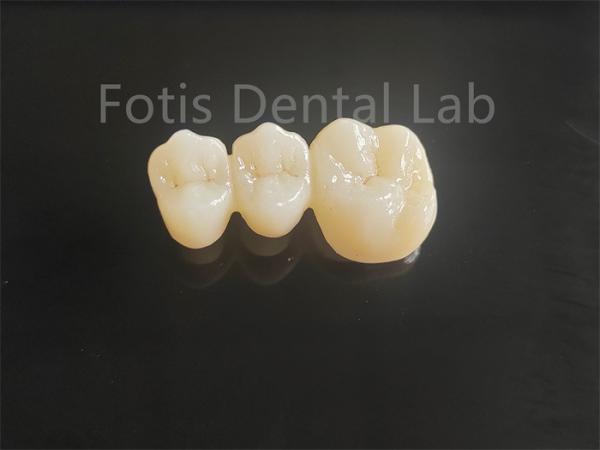 Buy cheap High Strength Porcelain Layered Zirconia For Long Lasting Dental Bridges from wholesalers