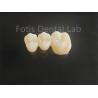 Buy cheap High Strength Porcelain Layered Zirconia For Long Lasting Dental Bridges from wholesalers