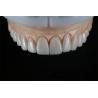 Buy cheap China Dental Lab Laminate Dental E-Max Veneer Self Adhesive from wholesalers