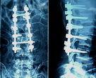 Fuji And Agfa Medical Dry Imaging Film For Hospitals And Clinics