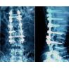 Buy cheap Blue AGFA Medical X Ray Films 10in x 12in , High Sharpness from wholesalers