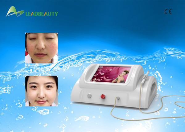 Quality Portable 30mhz rbs for spider vein varicose vein treatment machine for sale