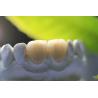 Buy cheap All Ceramic EMAX Porcelain Crown from wholesalers