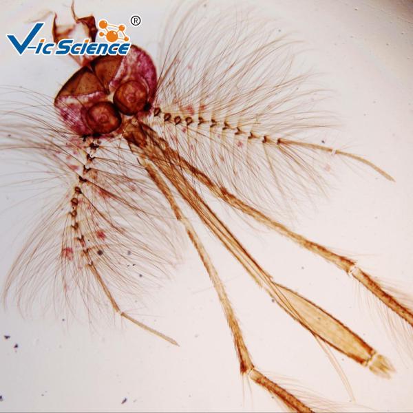 Buy cheap Medical Lab Stage Microscope Slide Female Mosquito Mouth Parts from wholesalers