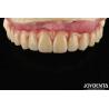 Buy cheap Comfortable Wear Titanium Malong Hybrid Bridge Dental Adjustable Design Light Weight from wholesalers