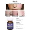 Buy cheap Visage Meso Therapy Serum Skin Treatment Essence Set Injection For Anti Aging Nourishing Safe Natural Effect from wholesalers