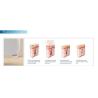 Buy cheap DISCOUNT Medical CE 10 bars 808 epilator laser hair removal machine/ 808nm diode laser/ laser diodo hair removal machine from wholesalers