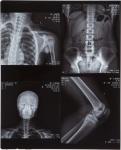 Blue Color 10X12 Inch Inkjet Pet Medical X-ray Film/Image
