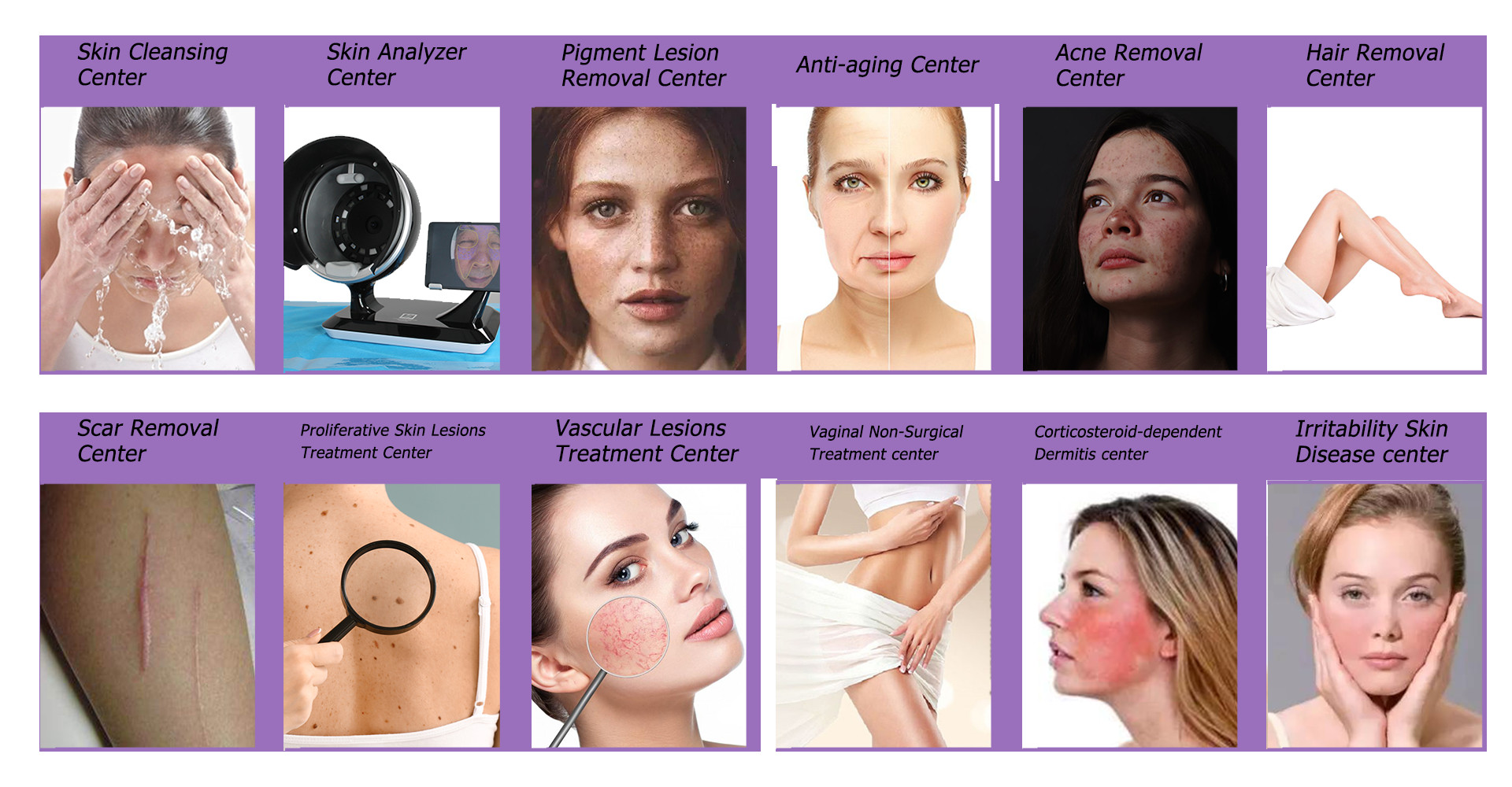 best body sculptor slimming roller liposuction suction machine vacuum anti cellulite massager