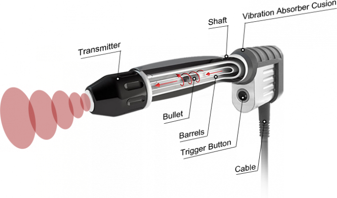 latest company case about Astiland Shockwave Therapy Machine Introduction 6