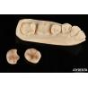 Buy cheap Natural Looking Composite Inlay Onlay Dental Restoration With Natural Appearance from wholesalers