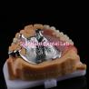 Buy cheap Upper Cast Framework Acrylic Metal Partial Dentures Strong Lightweight and Durable from wholesalers