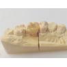 Buy cheap Precision Dental Inlay And Onlay For Accurate And Durable Restorations from wholesalers